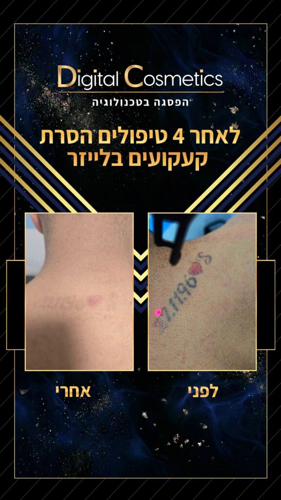 1ed9cbfa 04c8 44b4 ad41 38d4d034d45b