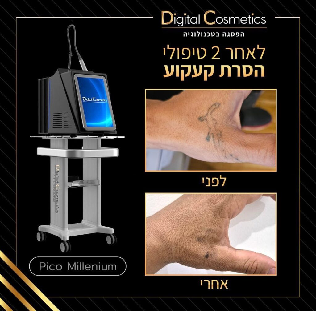 68cbd33f d65a 4025 adea 7858e4569023